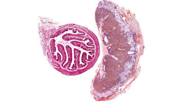 La microbiota intestinal materna protege el embarazo