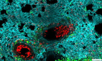 NeuMap: a pioneering map of neutrophils that redefines their role in health, infection, and inflammation